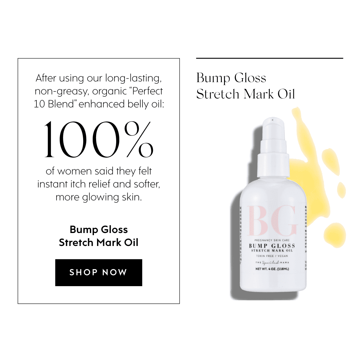 The Spoiled Mama Bump Gloss Stretch Mark Oil