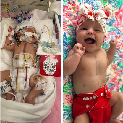 Three Little Tots CHD Heart Warrior Plastic Moment Cards