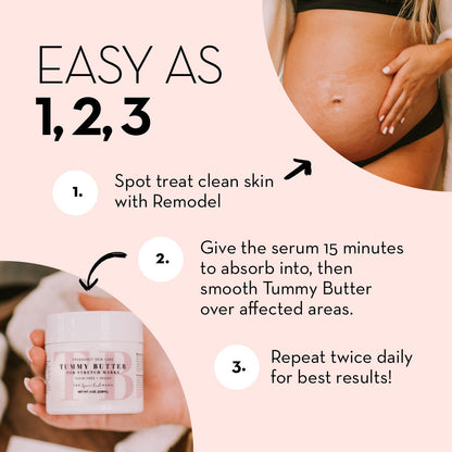The Spoiled Mama Tummy Butter & ReModel Serum Stretch Mark Duo Bundle