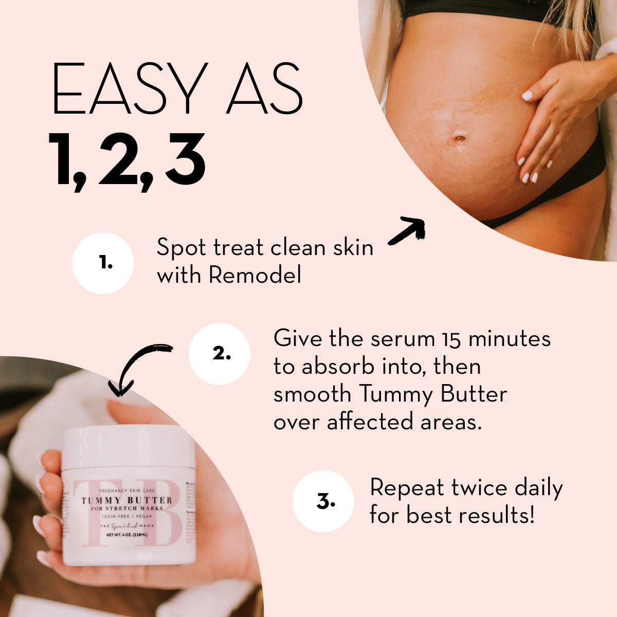 The Spoiled Mama ReModel Serum - Say Goodbye to Stretch Marks