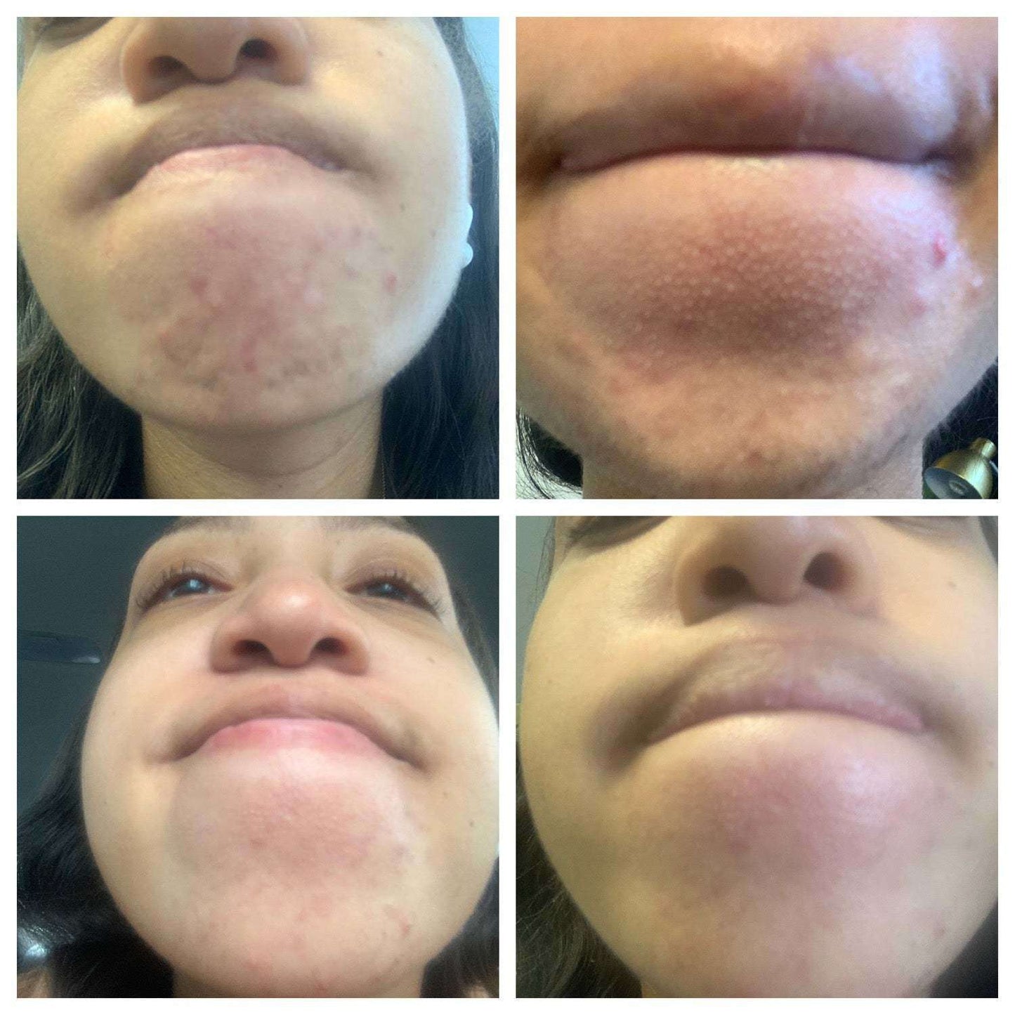 The Spoiled Mama BalanC Toner - Bright Clear Skin Pregnancy-Safe Acne Toner